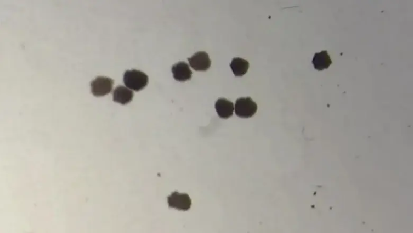 Anthrobots How Tiny Robots Made from Human Cells Are Revolutionizing Medicine 1 Anthrobots How Tiny Robots Made from Human Cells Are Revolutionizing Medicine